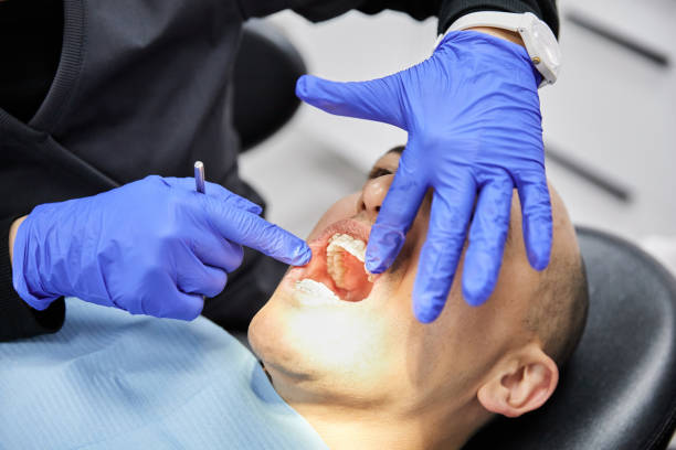 Best Urgent Care for Lost Fillings or Crowns in Fellsmere, FL