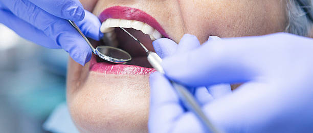 Best Emergency Dental Care for Broken or Chipped Teeth in Fellsmere, FL