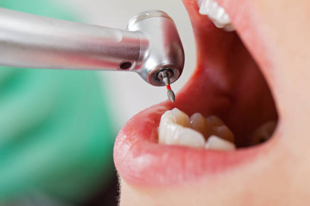 Best Emergency Gum Treatment in Fellsmere, FL